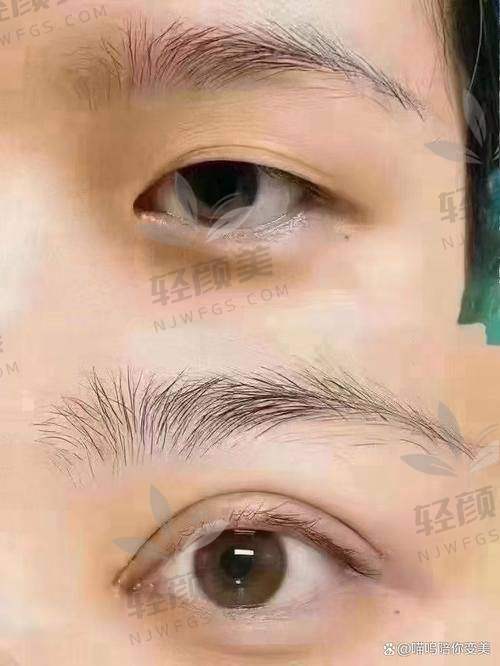 术后修复与护理