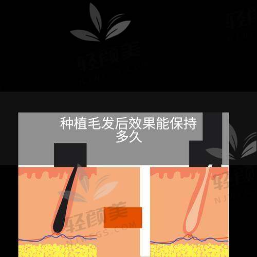 【兰州新禾植发美容诊所电话号码是多少】