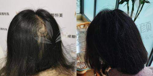 【兰州新禾植发美容诊所营业时间是什么时候】