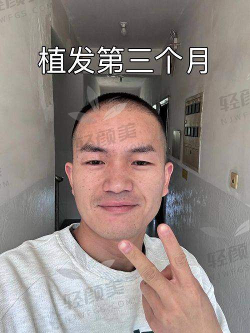 【兰州新禾植发美容诊所是正规的吗】