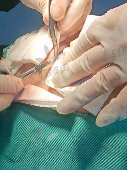 广州聂云飞医生在哪些医院坐诊?别急,地址全告诉你!