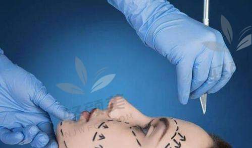 拉皮已经不算啥,新一代鼻祖级项目——第五代高位SMAS提升终于来了!