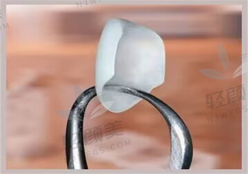 北京维乐口腔医生做冷光美白【1500元起/次】,价格合理选择多