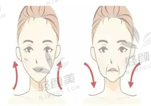 乌鲁木齐华美整形医院黄江泊做全面部小拉皮38000元起,技术可靠