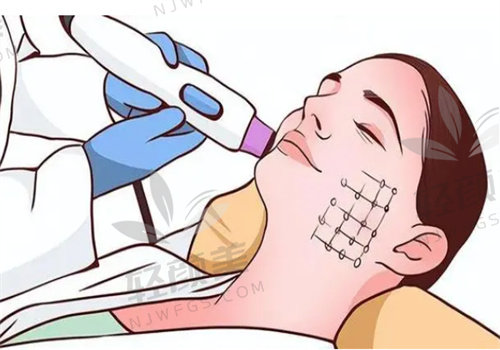 2026 黄金微针收费价格表，不同医院、不同部位收费有差异价格5000起