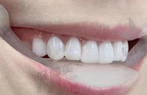 【西吉县皓齿怡仁口腔门诊部电话号码是多少】