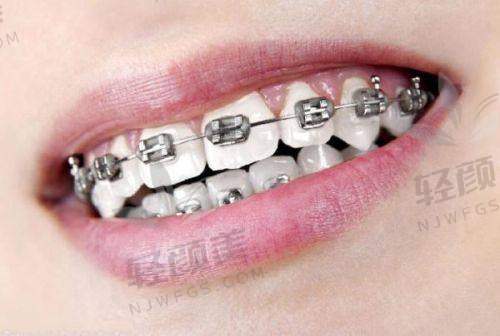 【西吉县皓齿怡仁口腔门诊部怎么预约挂号】