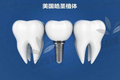 【西吉县皓齿怡仁口腔门诊部擅长什么项目】