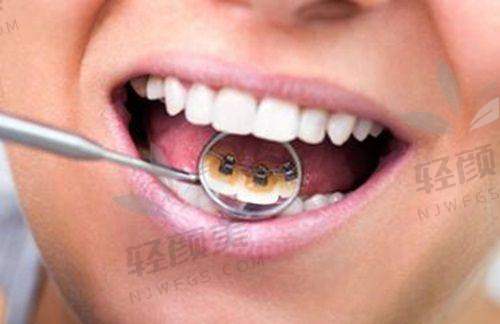 【西吉县皓齿怡仁口腔门诊部营业时间是什么时候】