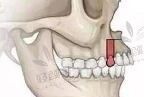 【西吉县皓齿怡仁口腔门诊部是正规的吗】