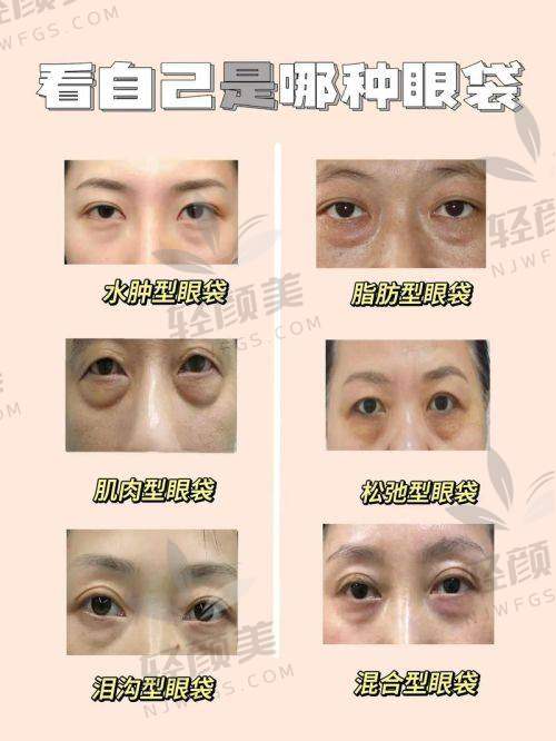 患者对林仙保医生及新疆威兹曼医院的口碑