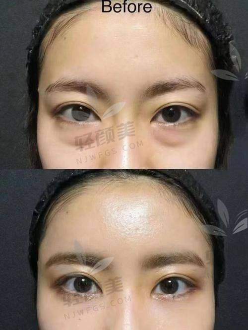 新疆威兹曼医院的优势