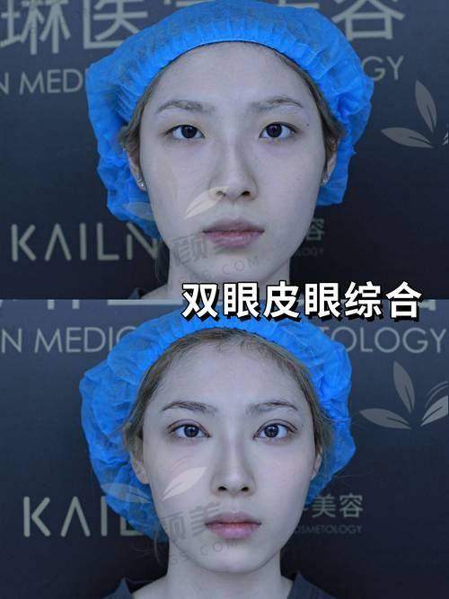 六、润百颜适合哪些人群？不是每个人都得打！