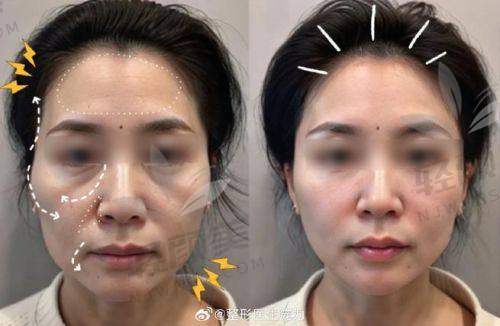 七、总结一下：润百颜这个牌子到底值不值得冲？