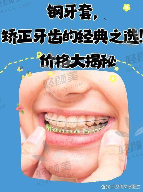北京维乐口腔李梦思做成人金属托槽国产矫正的技术优势