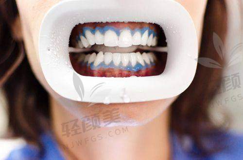 北京维乐口腔冷光美白的技术优势