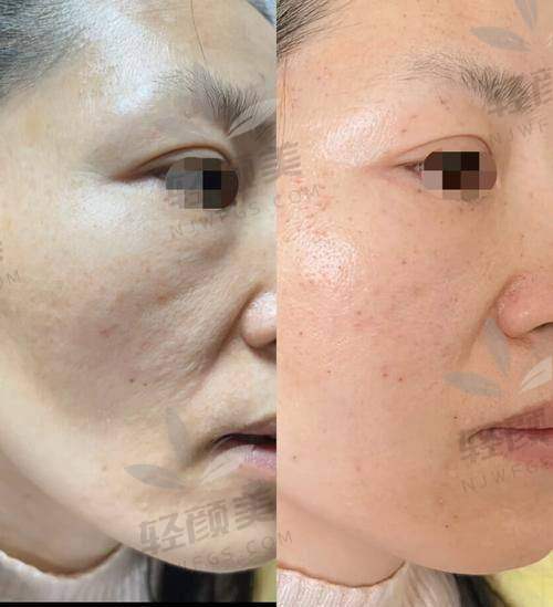 怎么预约徐鸿儒医生?