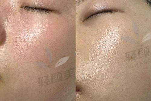 徐春菊医生擅长项目