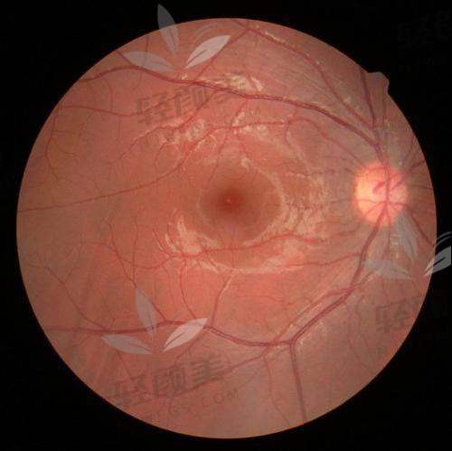 中国十大眼科医院排行榜上藏着啥秘密？各地特色眼科医院等你一探究竟